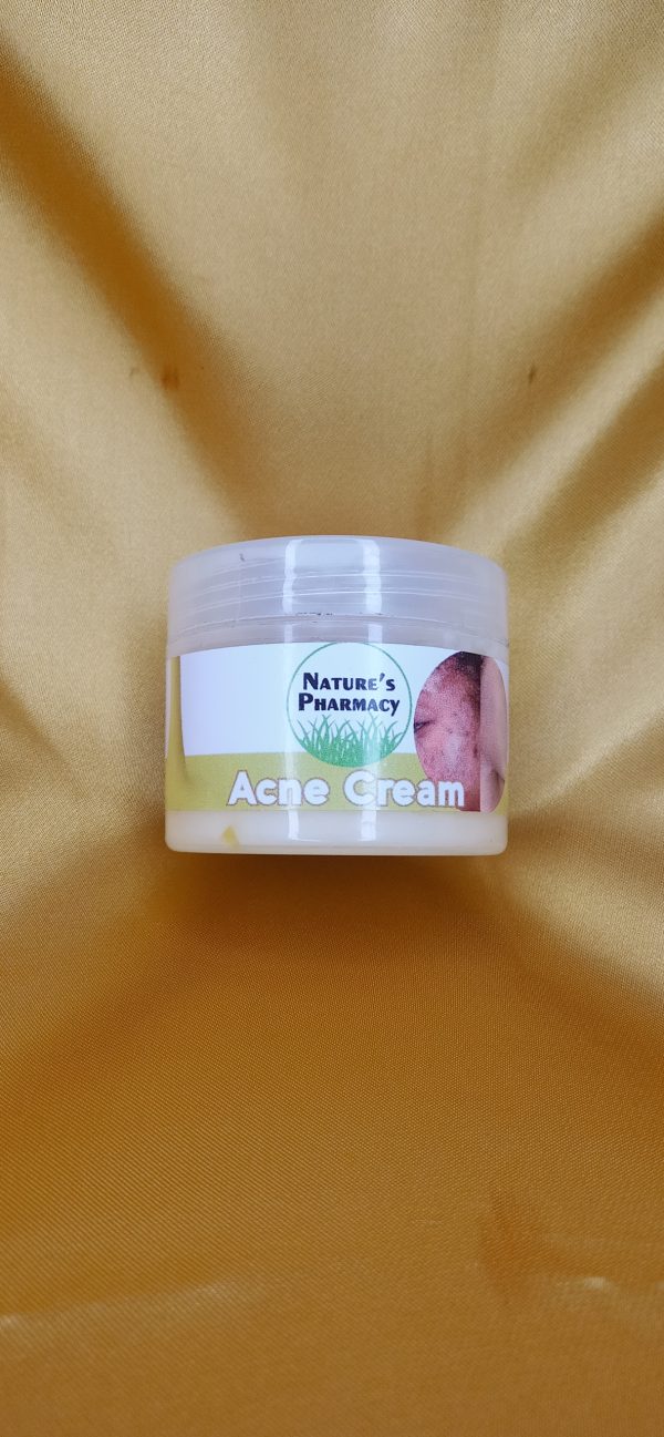 Acne Cream